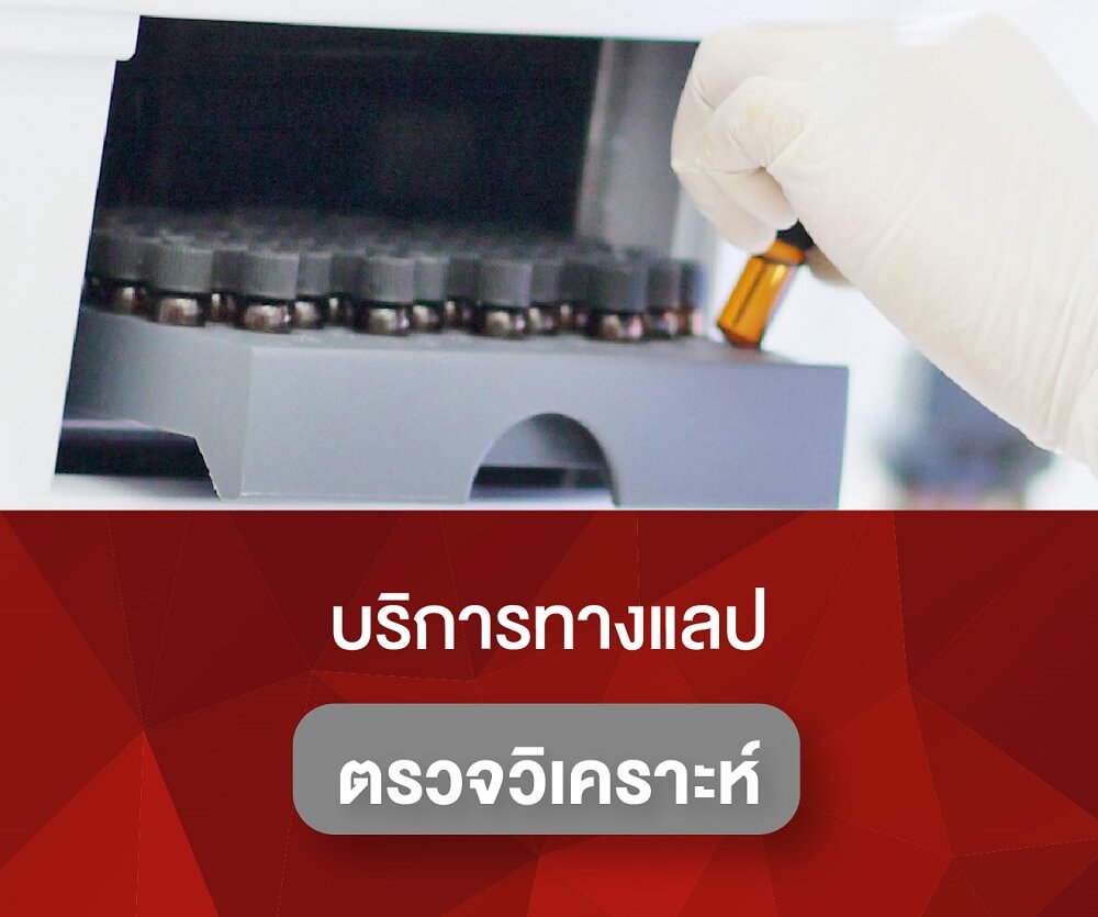 บริการทางแลปตรวจวิเคราะห์